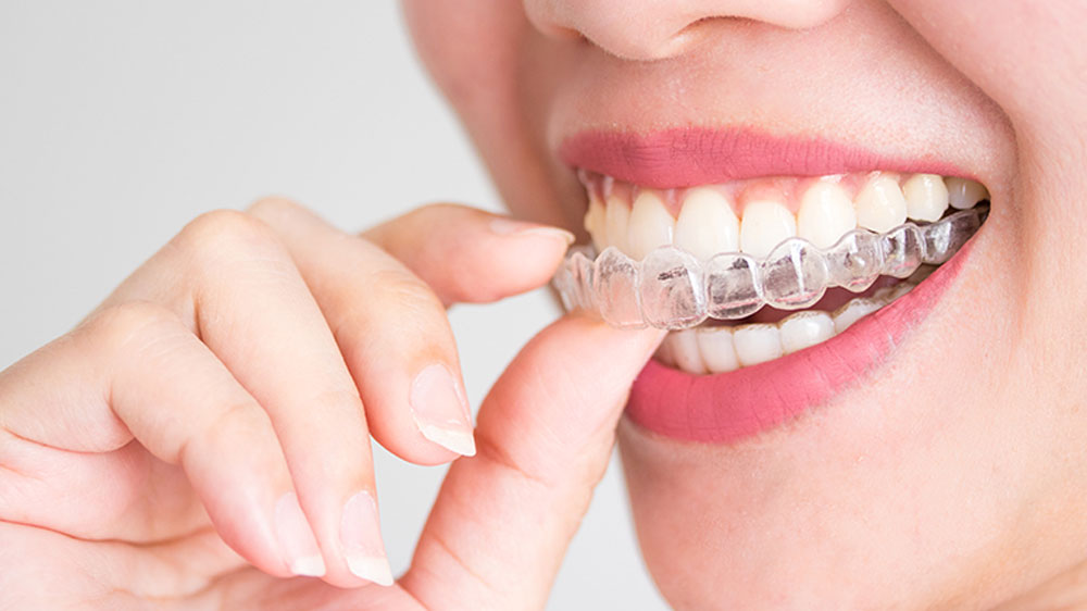 lady removing invisalign orthodontics clear aligner